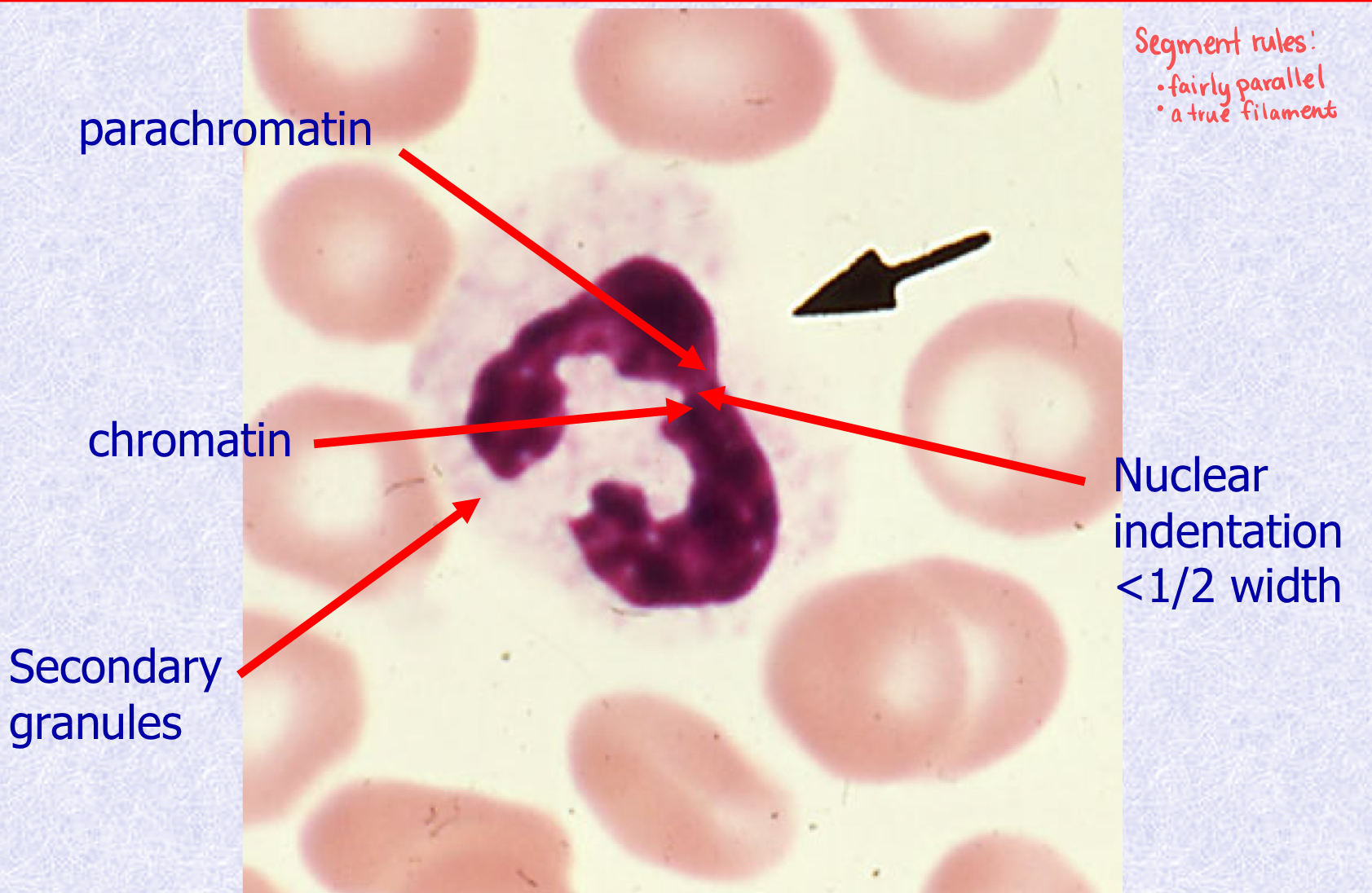 <p>What stage of Neutrophil Maturation is shown?</p>