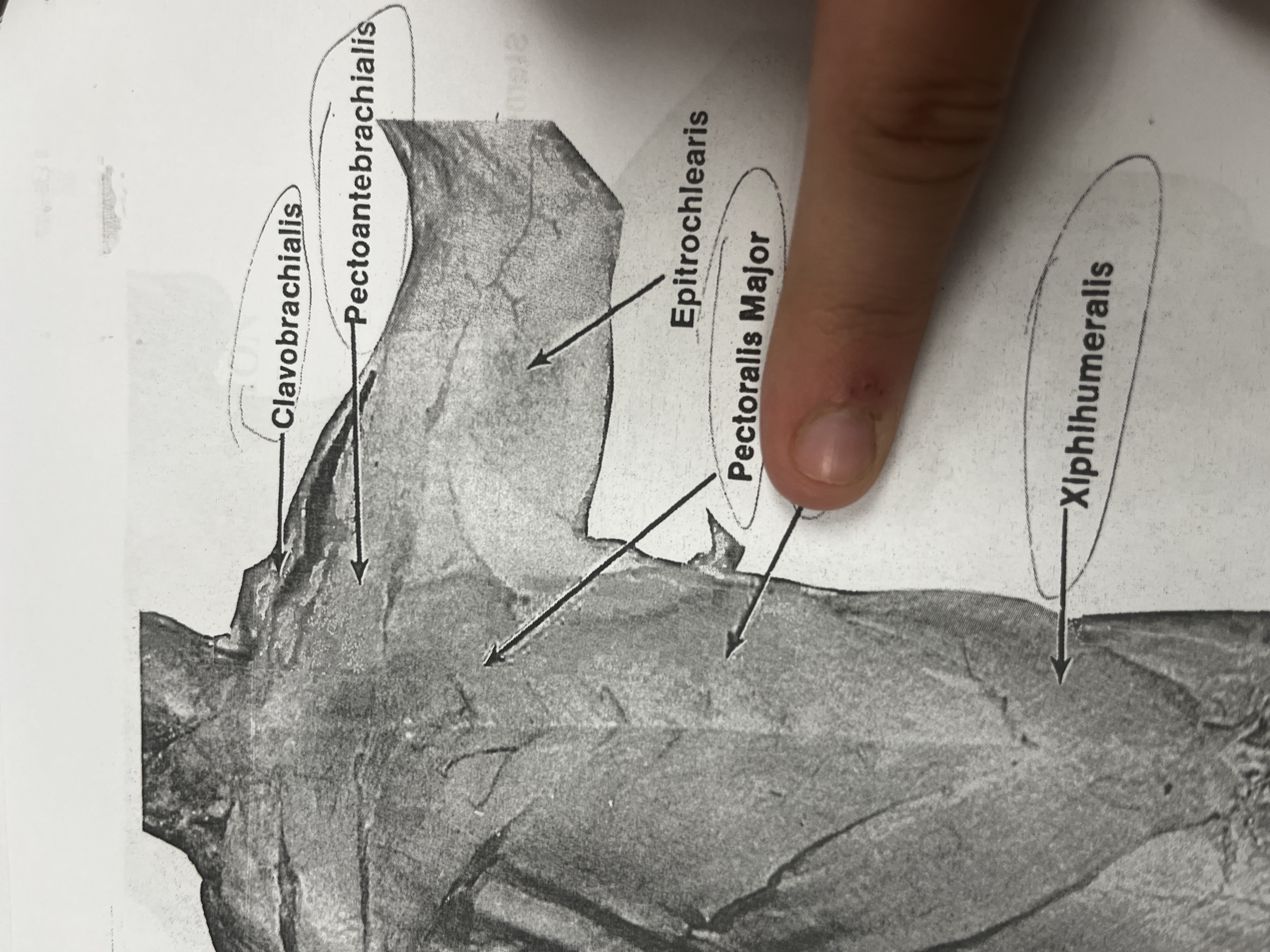 <p>A muscle located beneath the pectoralis major that aids in moving the scapula.</p>
