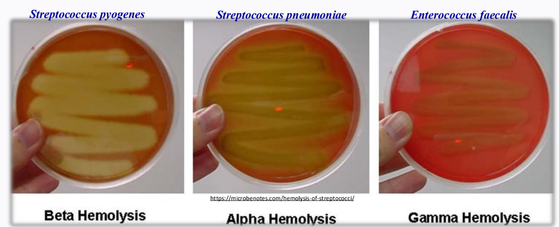<p>________Hemolysis - complete</p><p>_________ - partial only</p><p>_________ - non hemolytic </p>