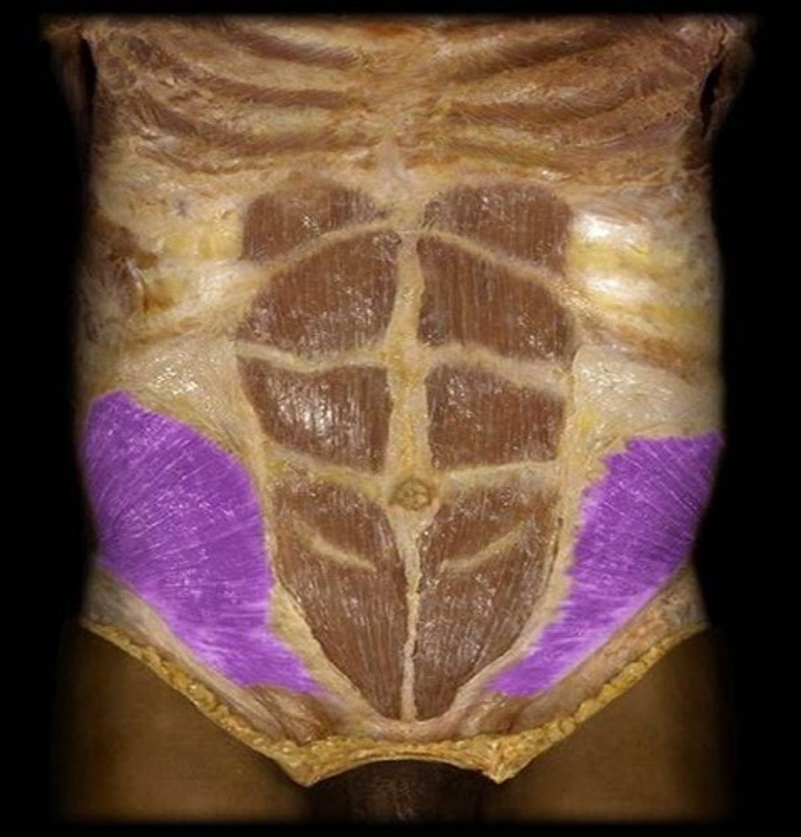 <p>What is the name of this muscle, highlighted in purple?</p>