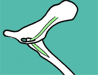 <p>Route:</p><ul><li><p>Passes through the OBTURATOR FORAMEN&nbsp;</p><ul><li><p>Is a short route,&nbsp;passes to medial thigh </p></li></ul></li></ul><p></p><p>Supplies the GAPE muscles (gracilis, adductor, pectineus, and external obturator)</p><ul><li><p>Hind limb ADDUCTORS</p></li></ul><p></p><p>Does not provide cutaneous sensation </p><p></p>