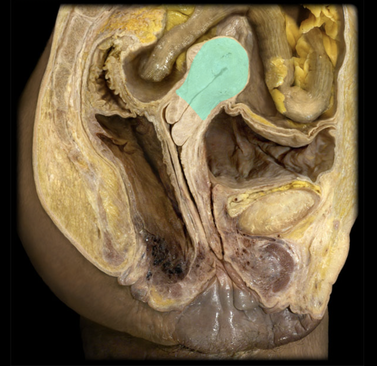 <p>What structure is shown?</p>