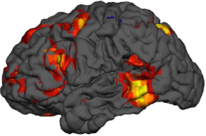 <p> <strong>fMRI?</strong></p>