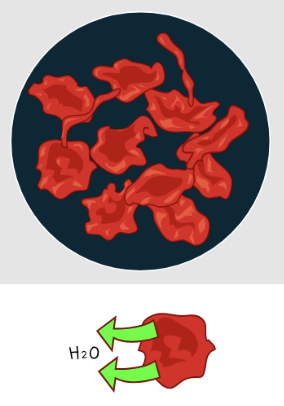 <p>Hypertonic solution</p>