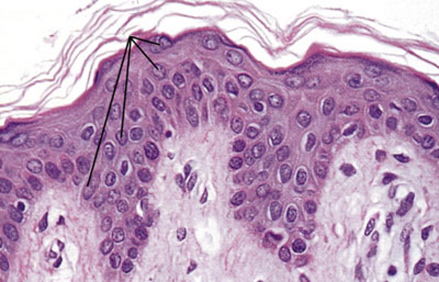<p>The most abundant epidermal cells, they function mainly to produce keratin.</p>