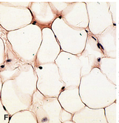 <p>stores fat </p><p>little extracellular matrix,</p><p>energy storage, insulation, cushioning&nbsp;</p><p>around heart, kidneys, under skin&nbsp;</p>