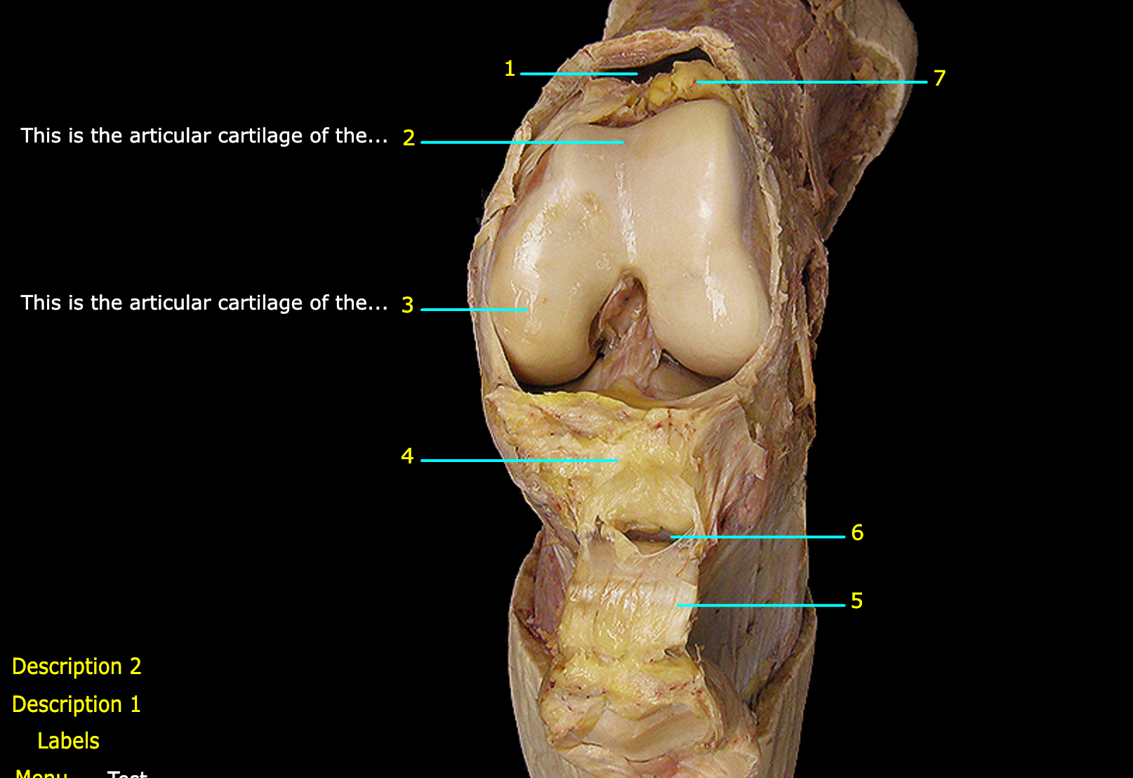 <p>What structure is labeled 3?</p>