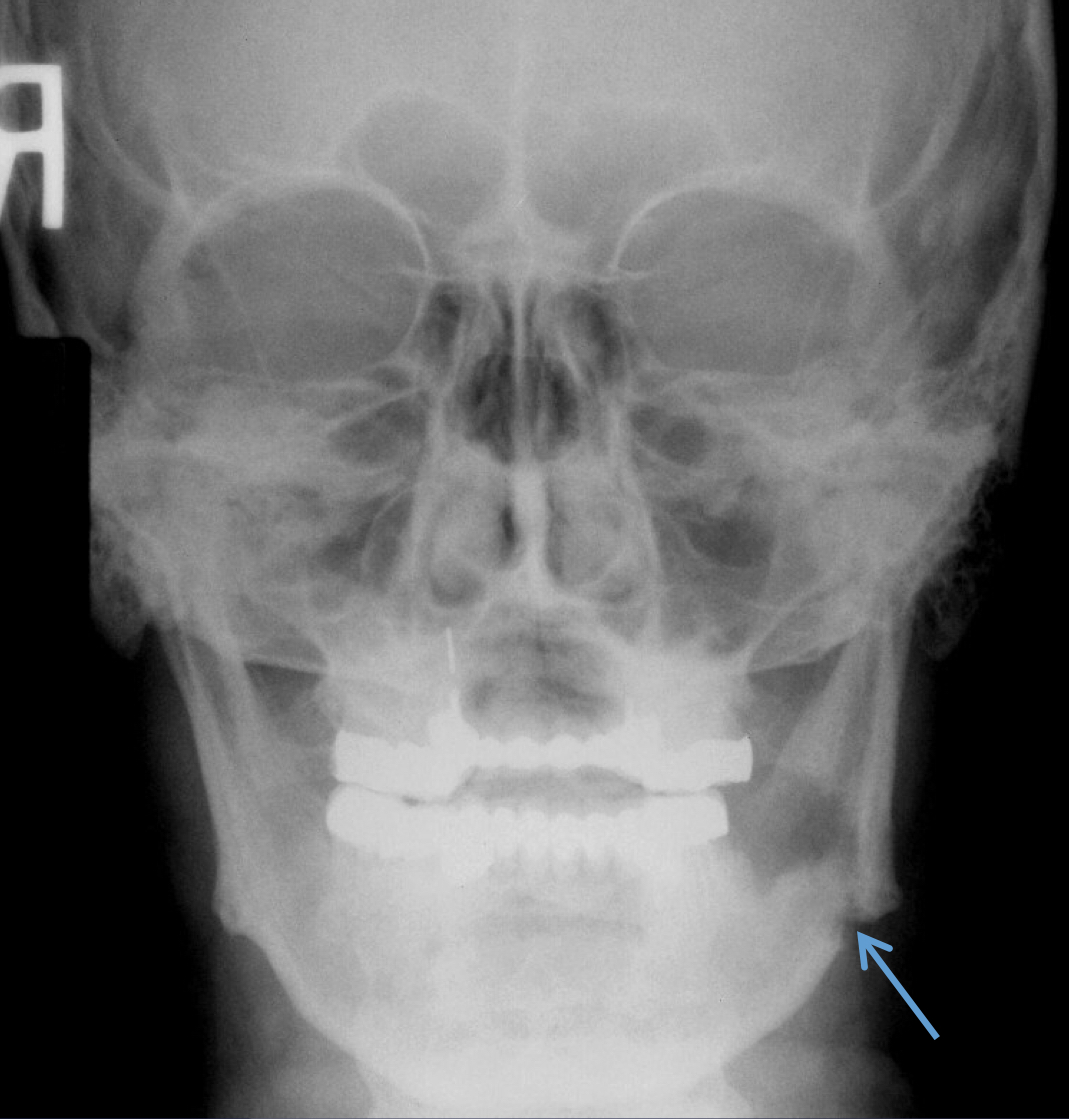 <p>what is going on here?</p>