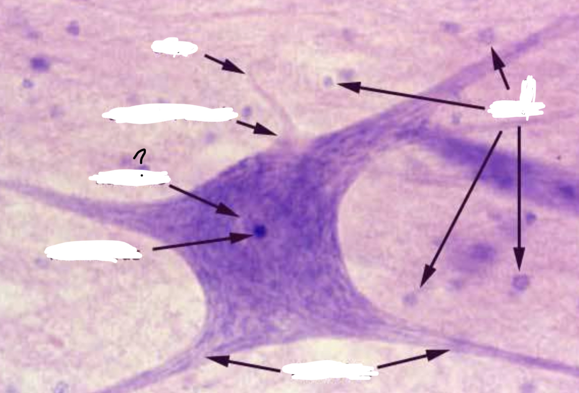<p>What is the arrow pointing to?</p>