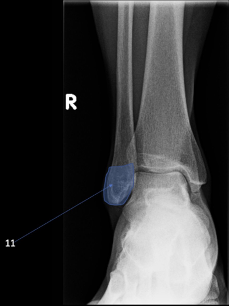 <p>ID 11</p>