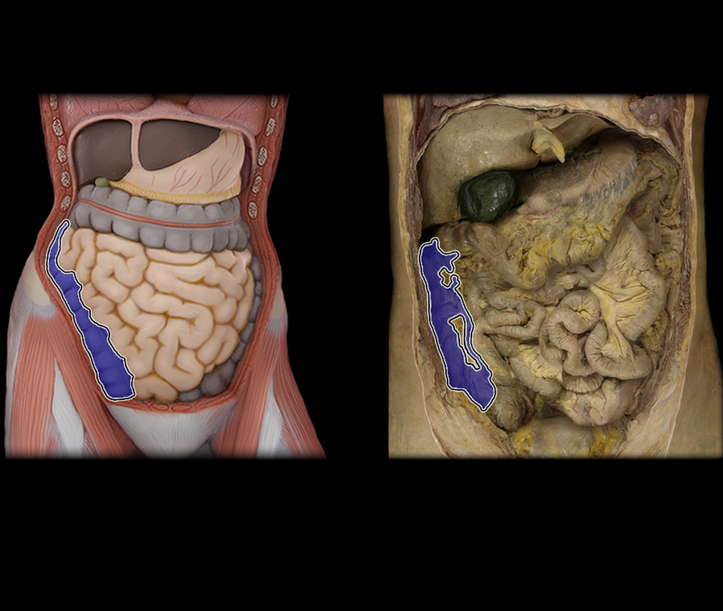 knowt flashcard image