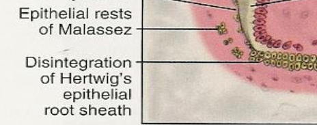 <p>ERM - Small clusters of epithelial cells located within the periodontal ligament (PDL).</p>