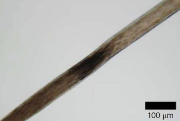 <p>Hairs may develop a band in the shaft proximal to an incompletely keratinized root of a hair that is still attached to a deceased individual.</p>