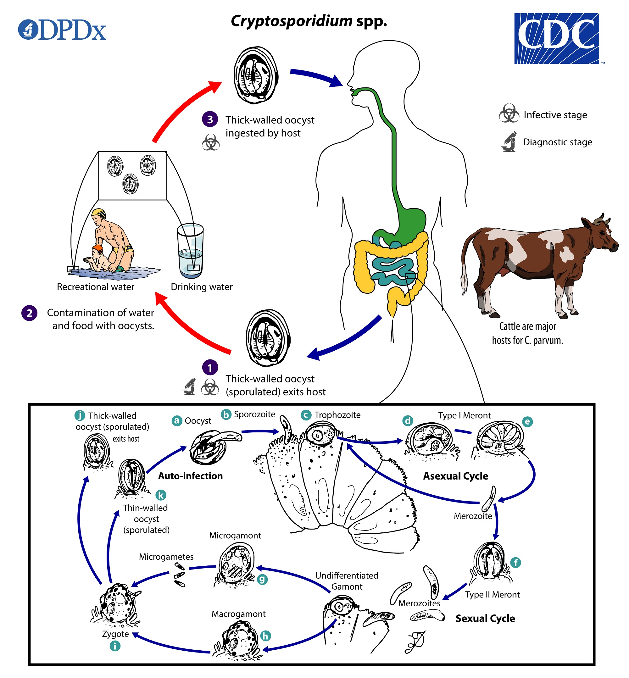<p>Cryptosporidium parvum — <strong>pathogenic</strong> </p><ul><li><p><strong>Type</strong>: Coccidia (infects <strong>brush border</strong> of small intestinal epithelium).</p></li><li><p><strong>ID</strong>: Oocysts <strong>~4–6 μm</strong>.</p></li><li><p><strong>Symptoms</strong>: <strong>Profuse watery diarrhea</strong>, cramps, nausea, anorexia — <strong>self-limited</strong> in immunocompetent; <strong>chronic/severe and extra-intestinal</strong> in immunocompromised.</p></li><li><p><strong>Bloody stool?</strong> No — typically <strong>watery</strong>.</p></li><li><p><strong>Stains/tests</strong>: <strong>Acid-fast</strong>; <strong>DFA</strong>; <strong>ImmunoCard STAT</strong> <strong>lateral-flow EIA</strong>; <strong>chromogenic immunoassay</strong>.</p></li></ul><p></p>