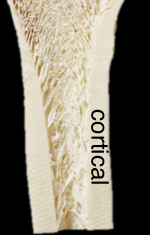 <p>Lattice arrangement of bony spicules deep to cortical bone</p>