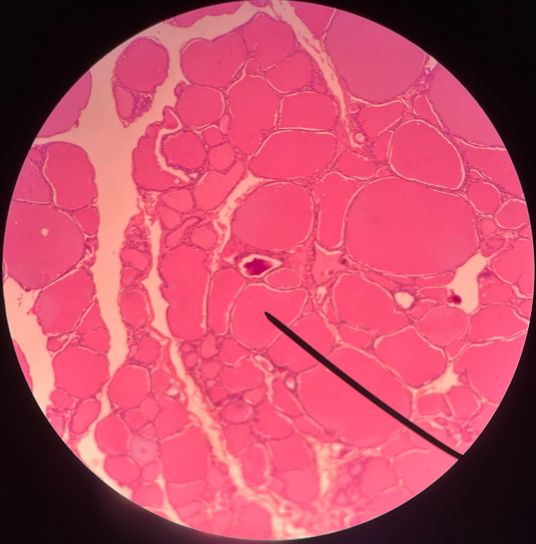 • Located inside a thyroid follicle.

• Stores thyroxine and triiodothyronine synthesized by the follicular cells.