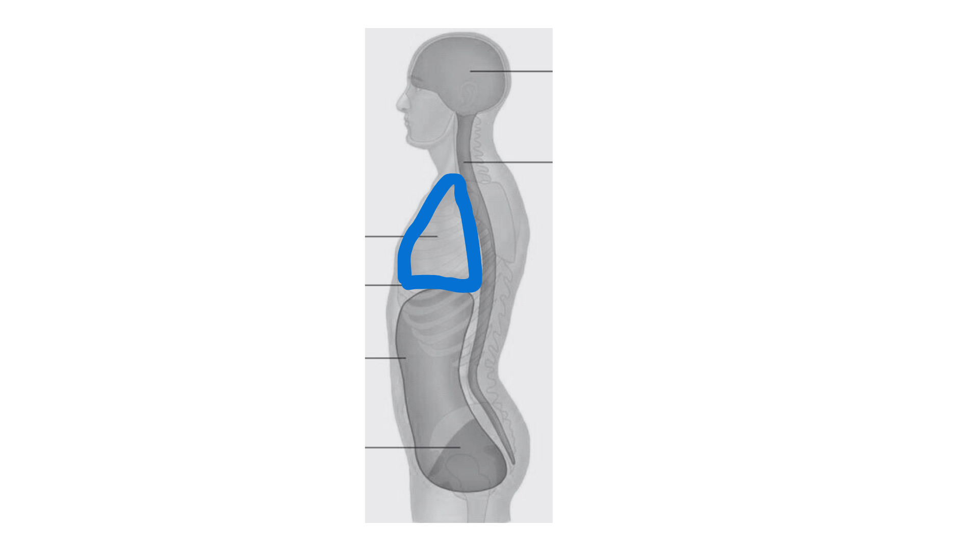 <p>Mediastinum</p>