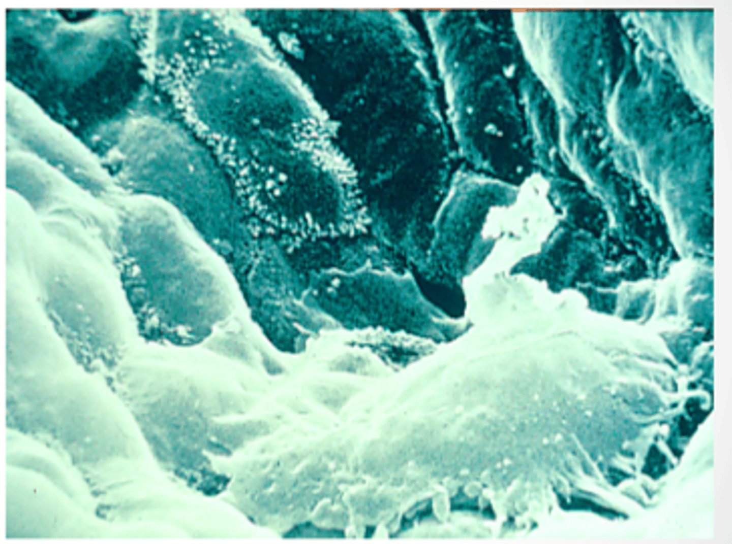 <p>phagocytosis of harmful particles</p>