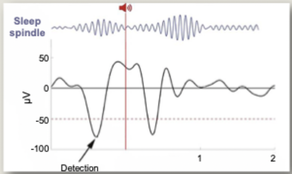 <ul><li><p>pharmacological and acoustic stimulation</p></li><li><p>initial trials in healthy participants confirms that acoustic stimulation of spindles can improve memory consolidation</p></li></ul><p></p>