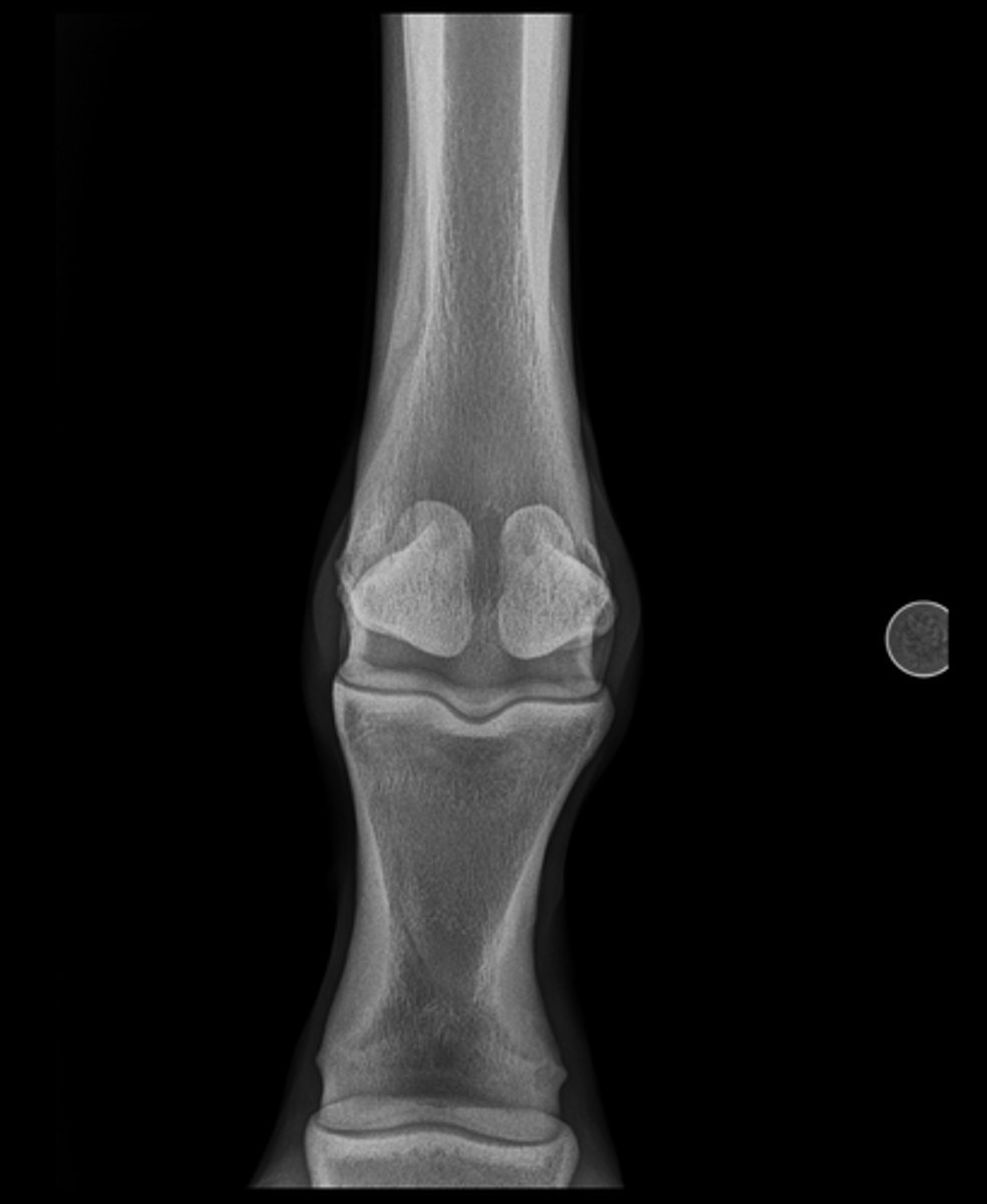 <p>Name the view and the anatomical region within the radiograph</p>