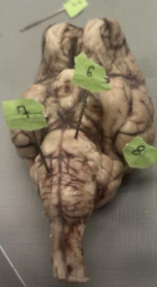 <p>What does number 8 represent on the brain?</p>
