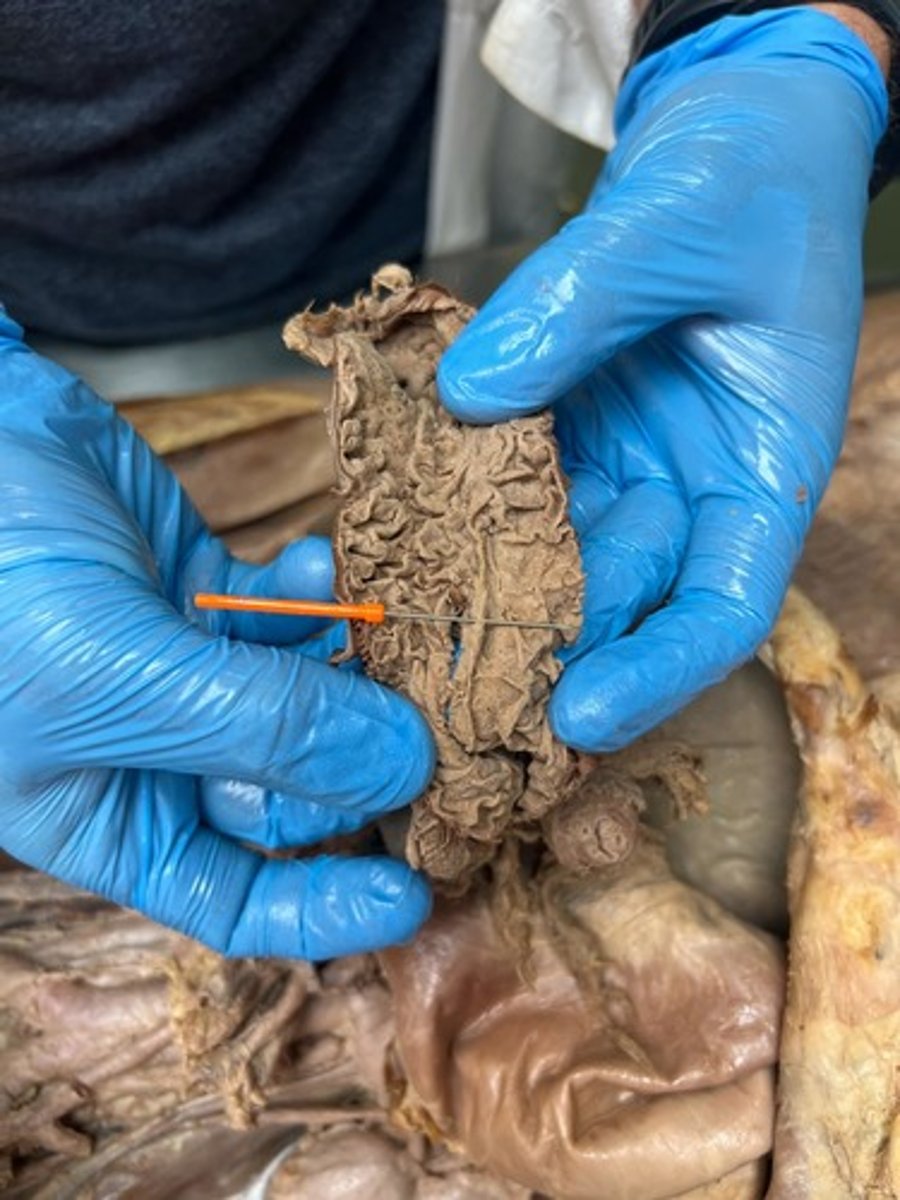 <p>longitudinal fold of duodenum</p>