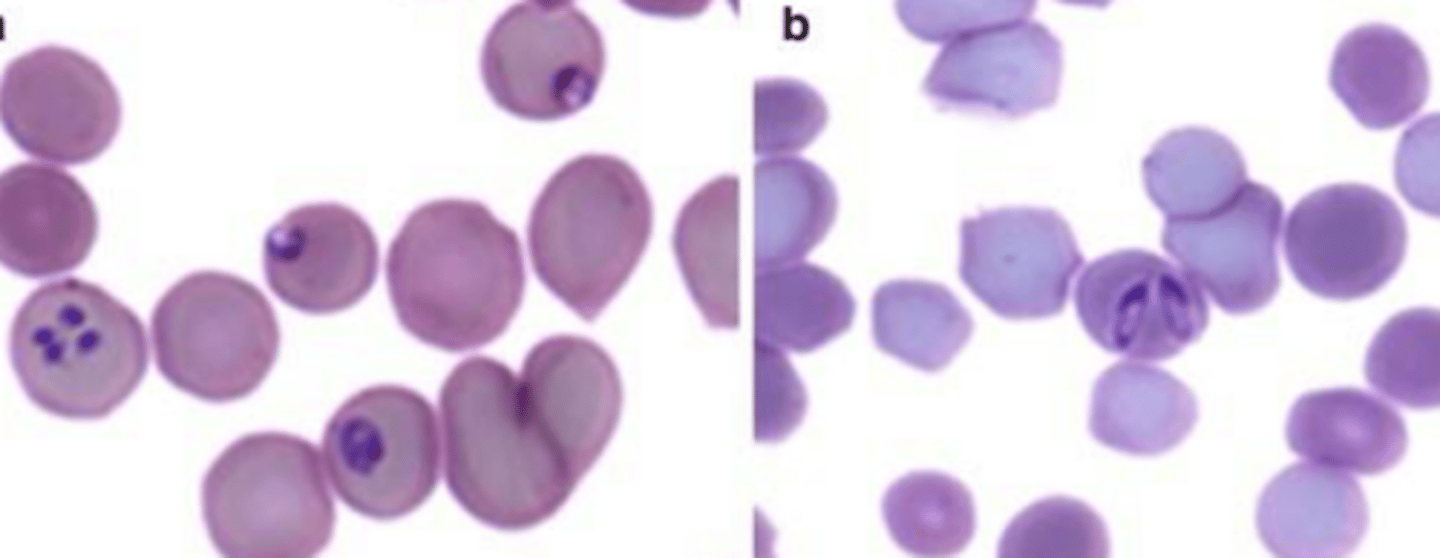 <p>What is Equine piroplasmosis</p>