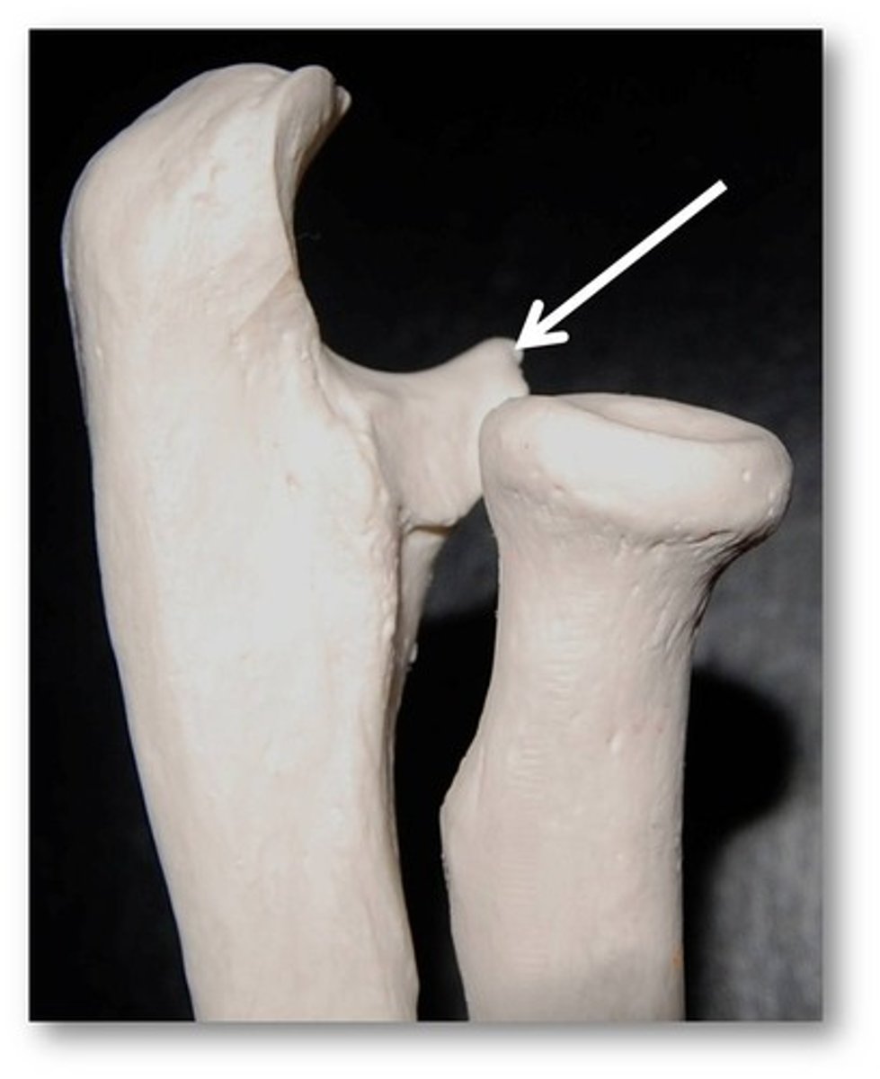 <p>inferior to the trochlear notch on the ulna</p>