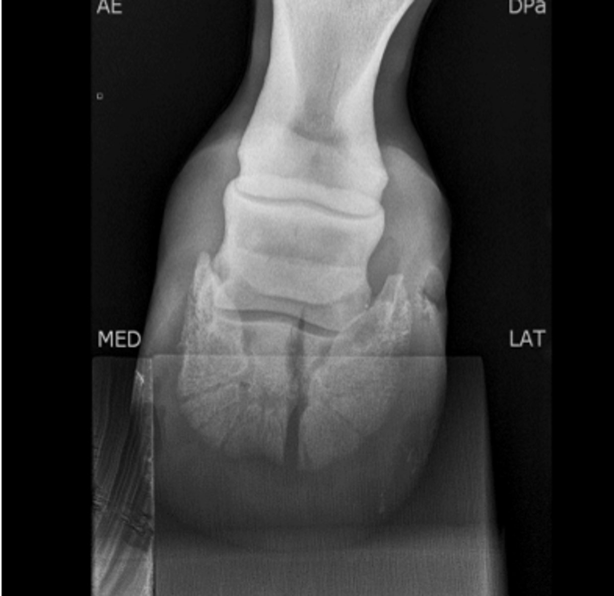 <p>What bone is fractured?</p>