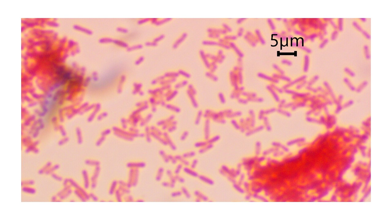 <p>gram negative</p>