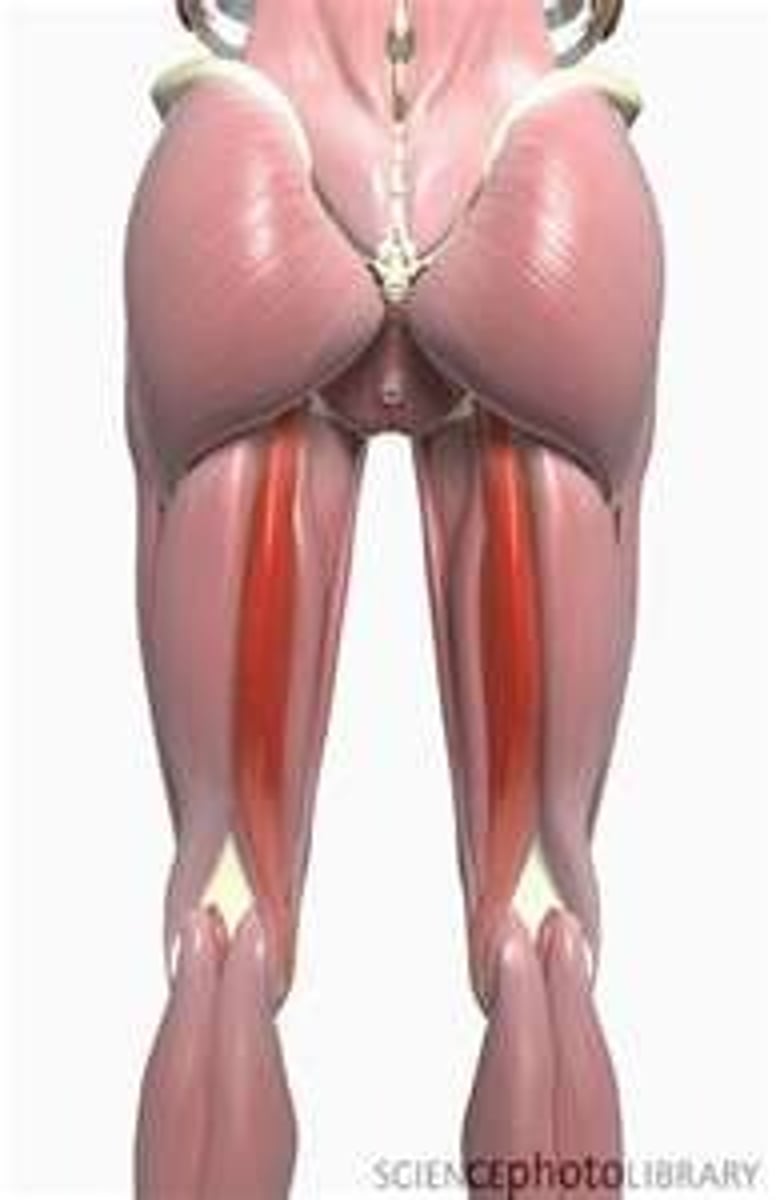 <p>Flex knee; extends thigh; medially rotates thigh at hip and knee (Hamstrings)</p>