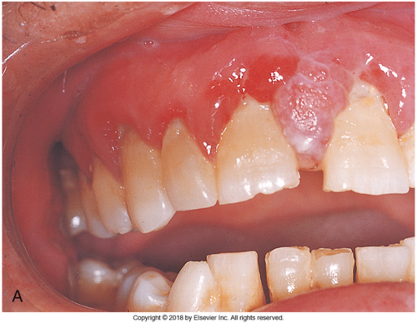 knowt flashcard image