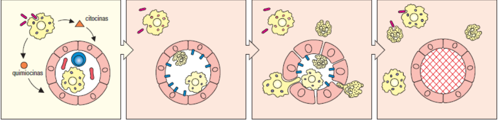 <p>explica el proceso de inflamación </p>