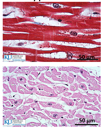 <ul><li><p>Contains a very branched structure</p></li><li><p>usually has a single central nucleus per fibre</p></li><li><p>due to branching, and unordered striations, there is no single direction of contraction</p></li></ul><p></p><p>Top image = longitudinal section of muscle</p><p>Bottom image = cross section of muscle</p>