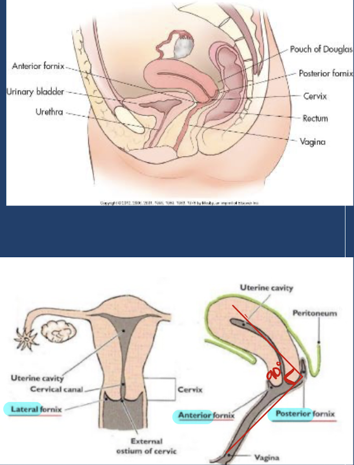 <ul><li><p>collapsed <span style="color: yellow;"><strong>muscular tube</strong></span> that extends <strong>from external genitalia to cervix</strong> of uterus</p></li><li><p><span style="color: yellow;"><strong>posterior</strong> to <strong>bladder</strong> and <strong>urethra</strong></span></p></li><li><p><strong>anterior</strong> to <strong>rectum</strong> and <strong>anus</strong></p></li><li><p>forms 90-degree angle with uterine cervix</p></li><li><p><strong>vaginal lumen</strong> surrounding cervix is <strong>divided into </strong><span style="color: yellow;"><strong>4 fornices</strong></span>:</p><ul><li><p>anterior</p></li><li><p>posterior</p></li><li><p>lateral (x2)</p></li></ul></li></ul><ul><li><p><strong>inner walls </strong>from <strong>vaginal canal</strong></p></li><li><p><strong>outer walls</strong> form <strong>muscular layer</strong></p></li></ul><p></p>