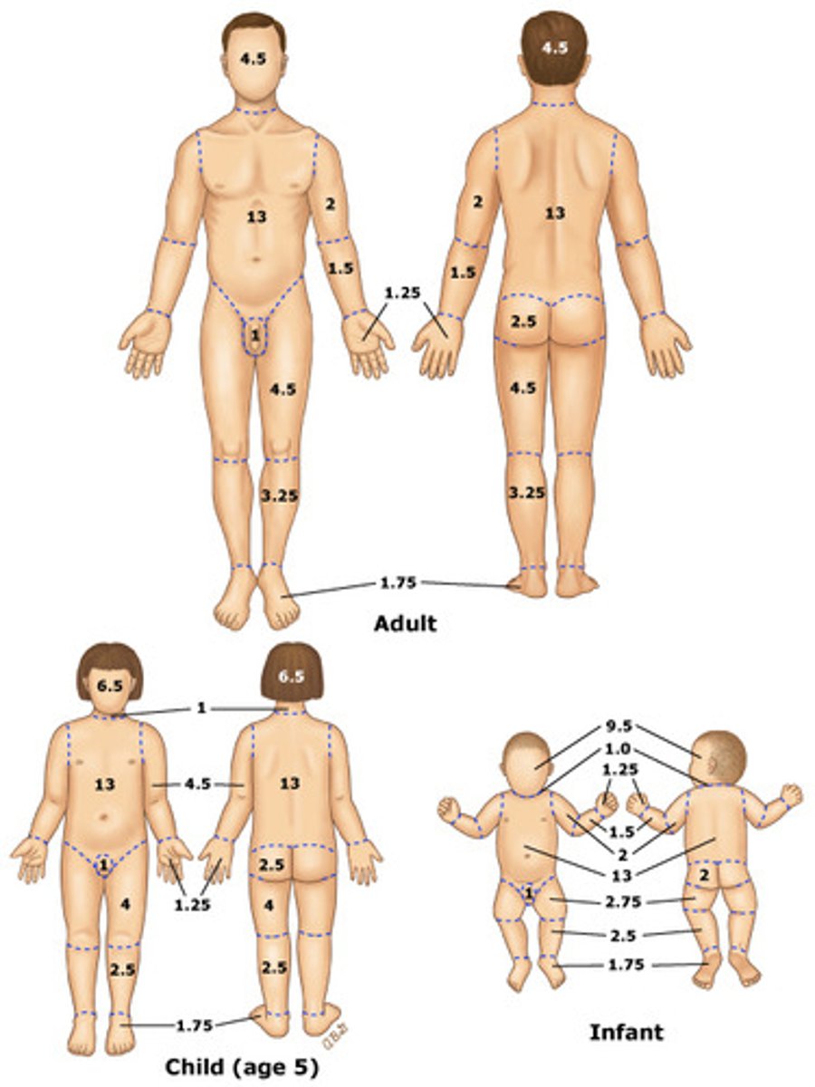 <p>A detailed version of the rule of nines chart that takes into consideration the changes in body surface area brought on by growth. → most accurate</p>