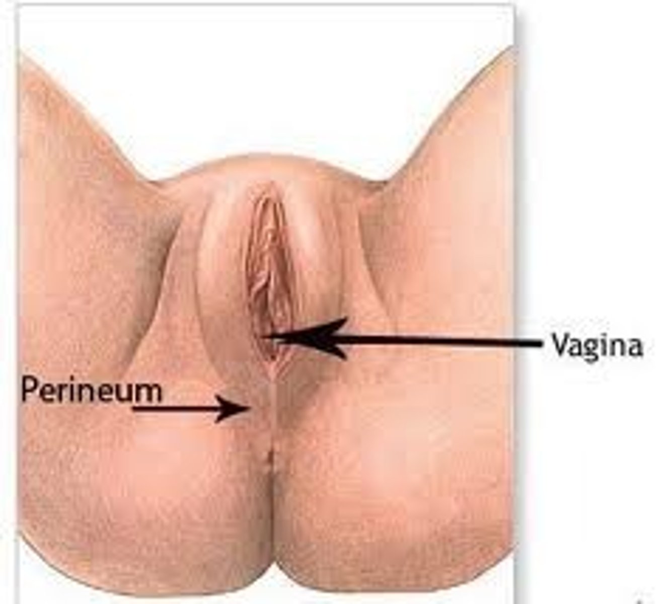<p>Vestibule</p><p>-space into which the vagina and urethra open</p><p>Labia minora/minus</p><p>-folds that cover the vestibule and form the prepuce</p><p>Labia majora/majus</p><p>-cover the labia minora, unite to form the mons pubis</p><p>Mons pubis</p><p>-elevated fat deposit anterior to the symphysis pubis</p><p>Pudendal cleft</p><p>-space between the labia majora</p><p>Clinical perineum</p><p>-region between the vagina and the anus</p>