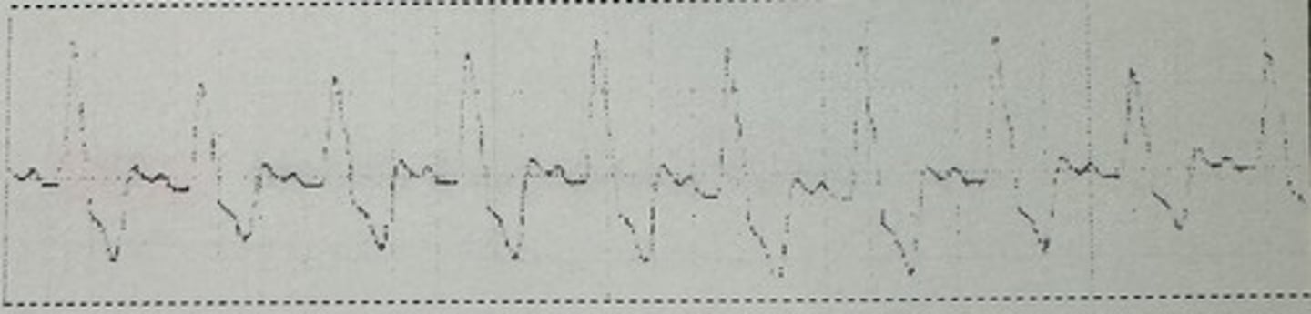 <p>identify the rhythm</p>