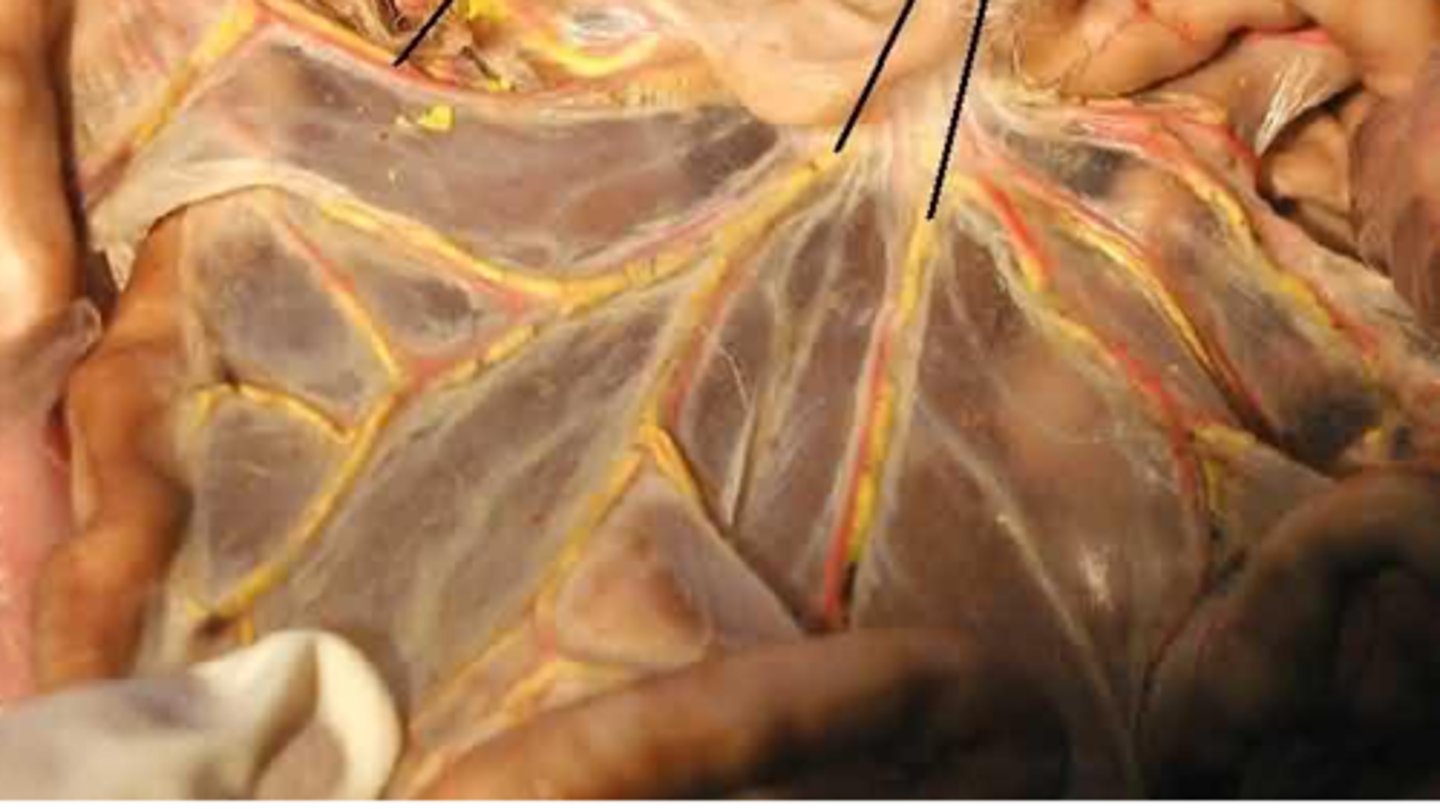 <p>holds the pancreas in place</p><p>part of the peritoneum</p>