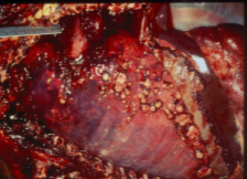 <p>where is the fungal infection?</p>