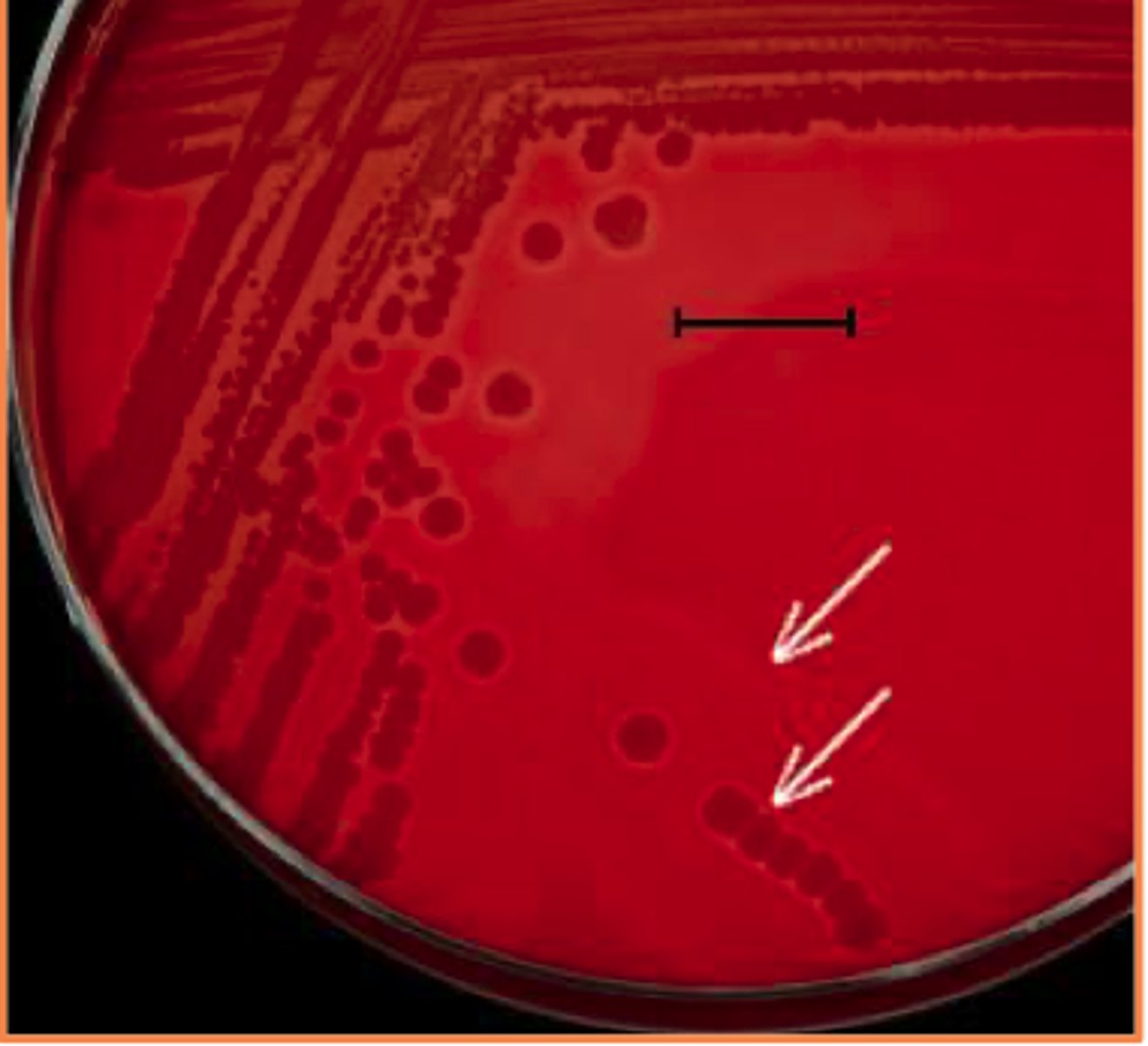 <p>A dairy cow develops sudden, severe mastitis in one quarter. Milk is watery with flakes and small blood clots . The quarter is swollen and painful.</p><p>Biochemical Tests</p><p>Catalase: Positive</p><p>Coagulase: Positive</p><p>No MAC Growth </p><p>Cytology Reveals Purple clusters of Cocci</p>