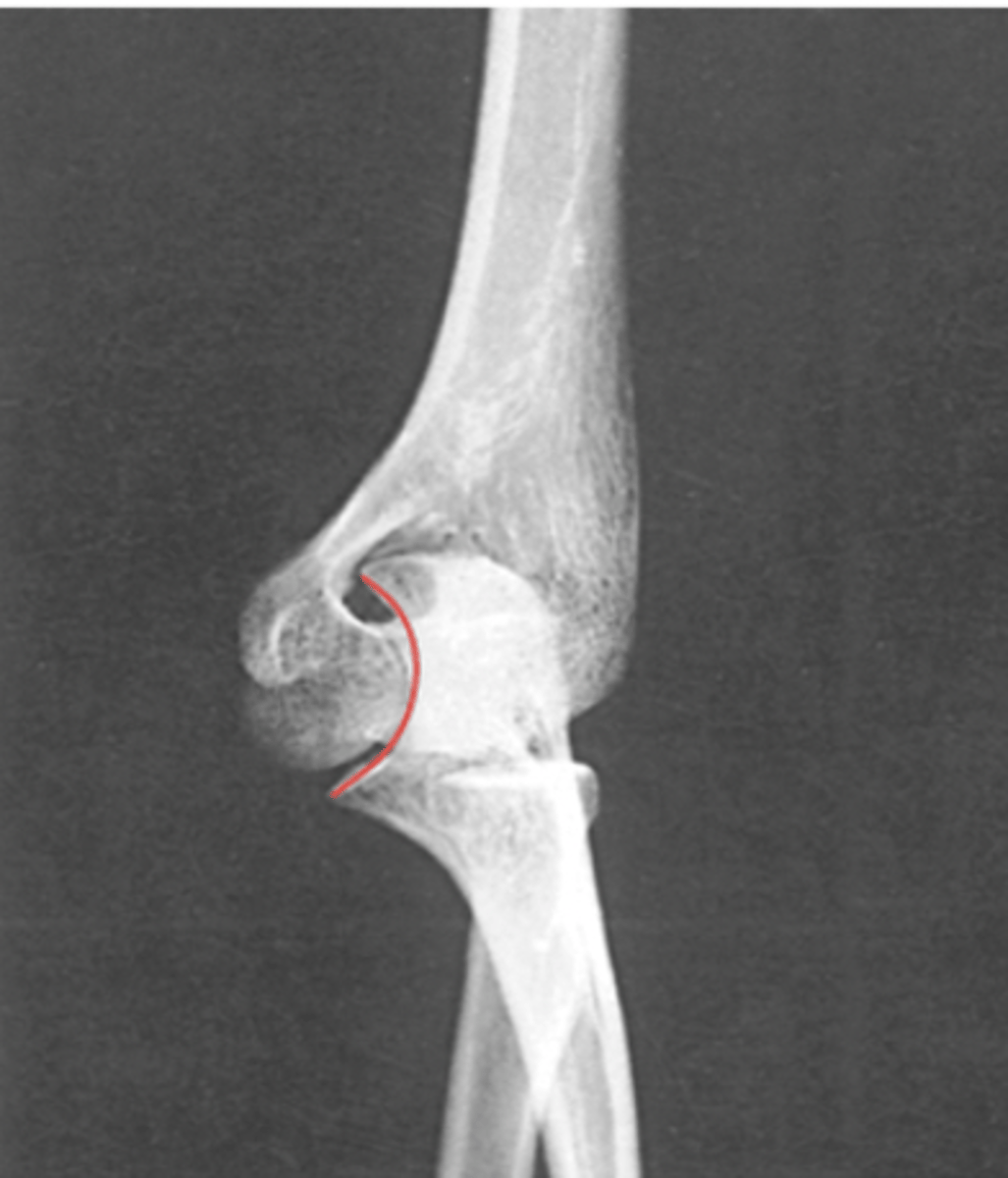 <p>What structure is highlighted?</p>