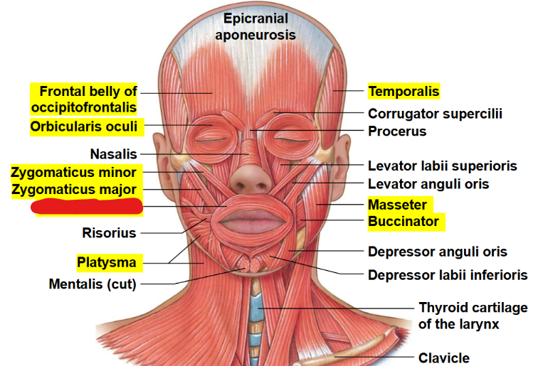 <p>What muscle is this?</p>