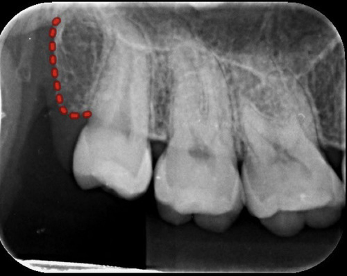 <p>What is the red dotted line representing?</p>