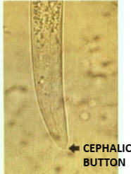 <p>sheep lungworm</p>