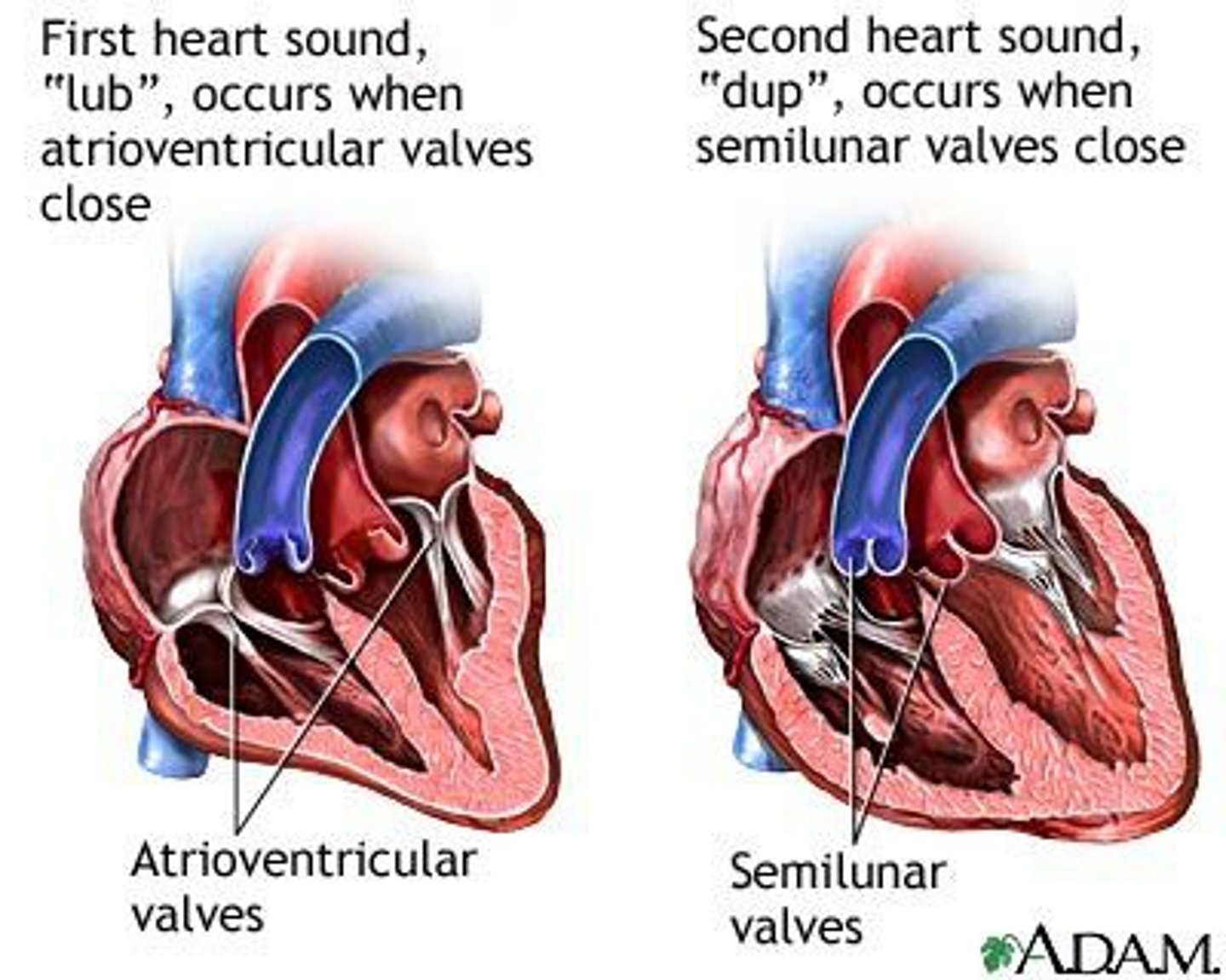 <p>closure of semilunar valves</p>