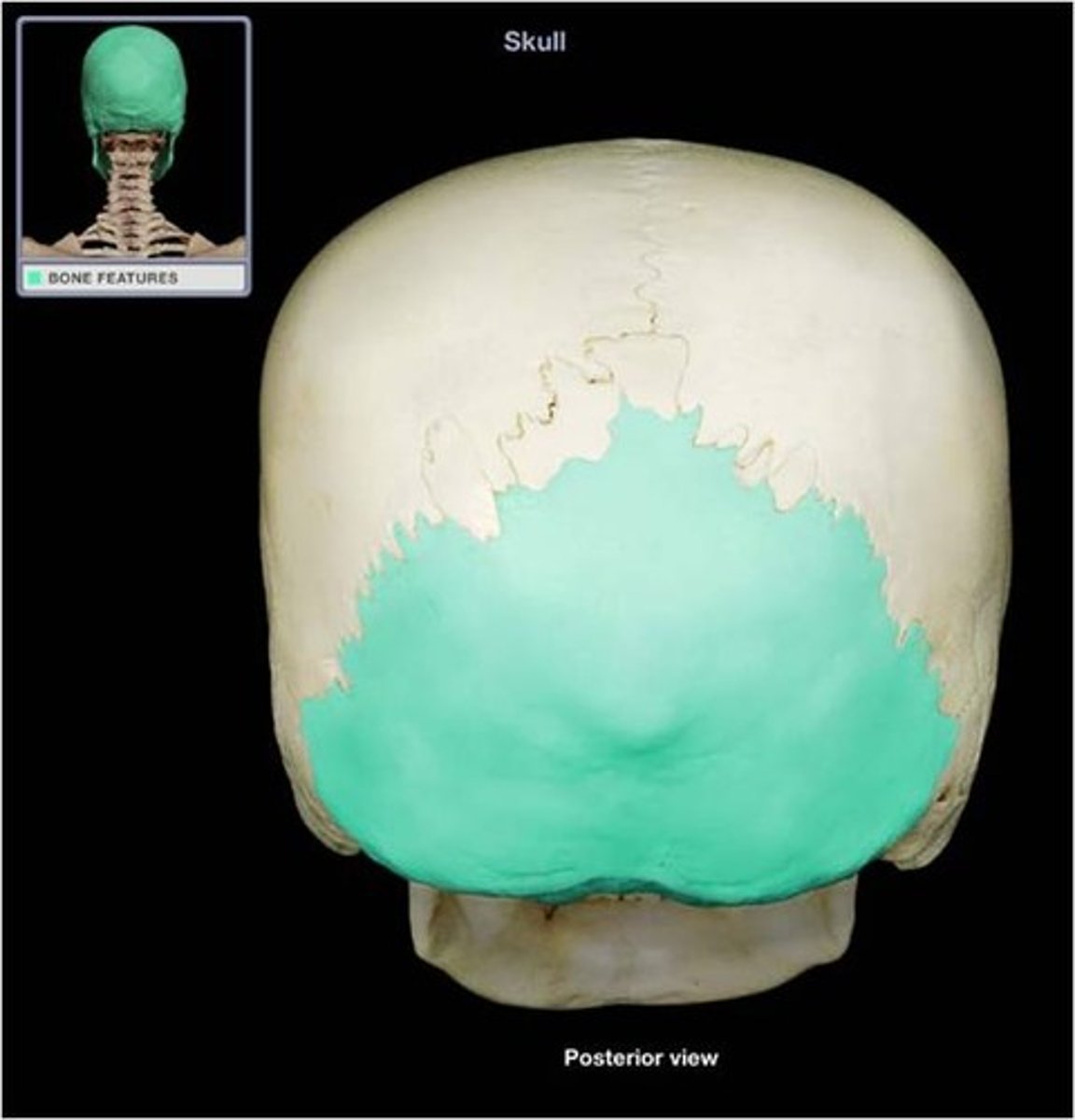 <p>Bone forming the back of the skull.</p>