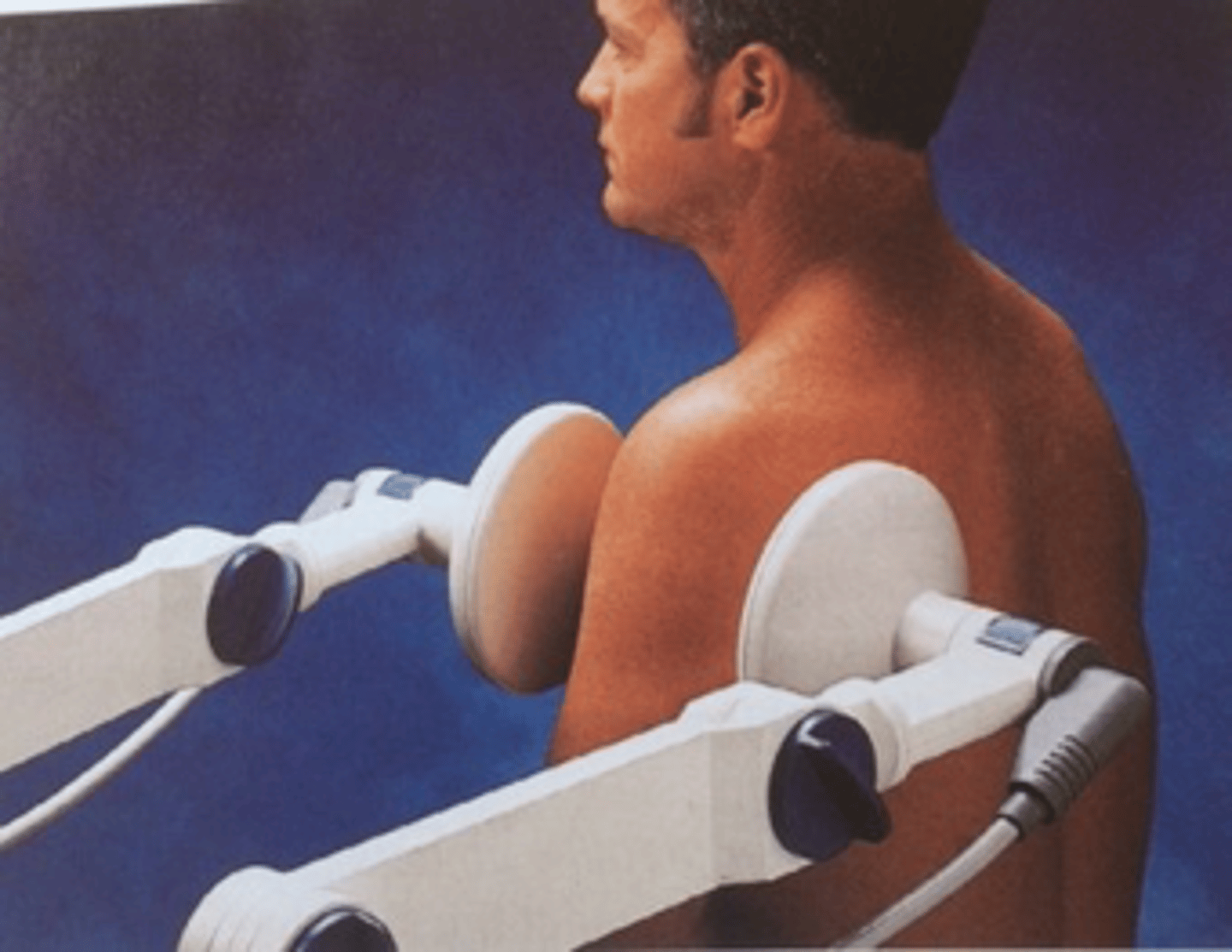 <p>Application of high radiofrequency current/electromagnetic field to underlying tissue</p><p>Deep heating is caused by the conversion of energy into heat as it passes through tissue, due to the resistance of the tissue to the passing of the energy</p><p>Heating of deeper structures can be obtained through the application of high frequency electrical currents</p><p>Different frequency ranges will affect specific tissue types at different depths</p><p>The advantage to SWD is that the overall area that can be heated will be larger than those covered by a hot pack or US</p><p>can also do non thermal setting</p>