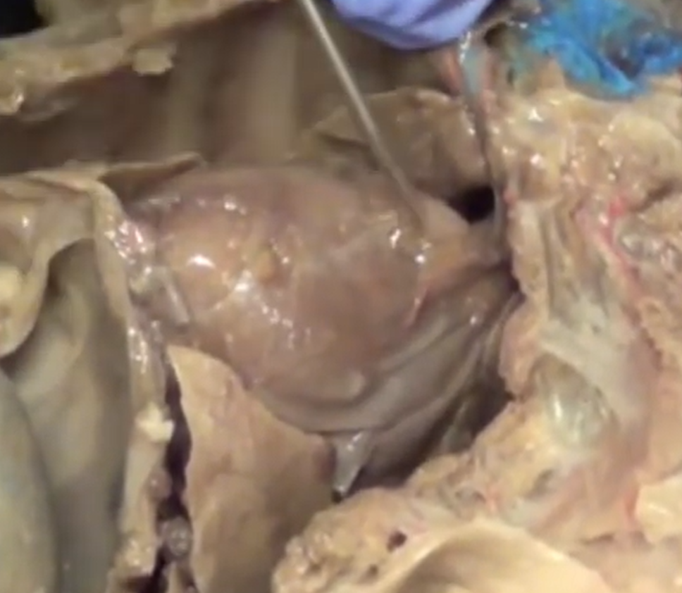 <p>The probe is poking a gland. What is this gland? Purpose?</p>