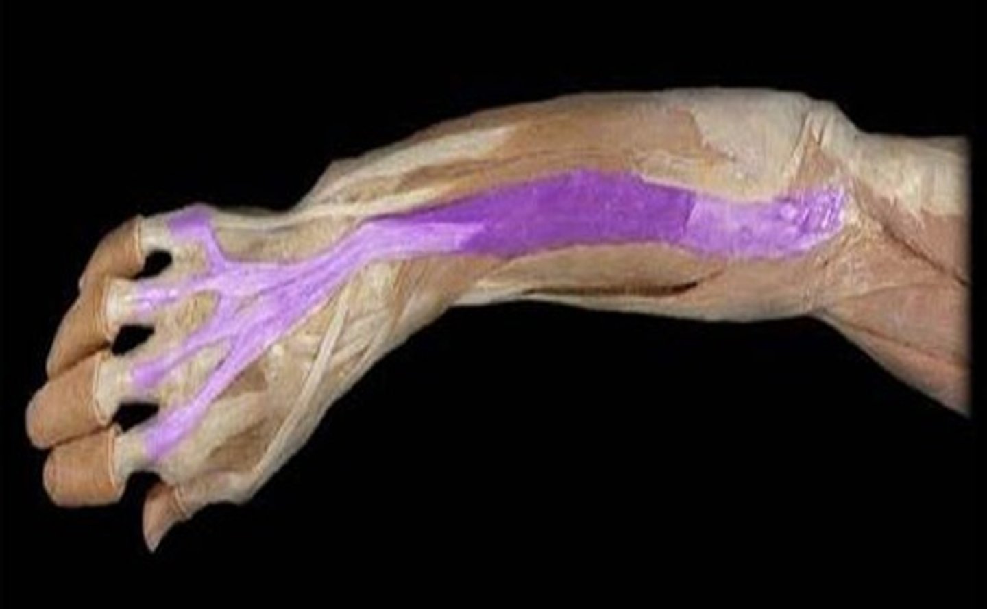 <p>What is the name of this muscle, highlighted in purple?</p>